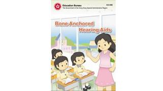Thumbnail of Bone Anchored Hearing Aids